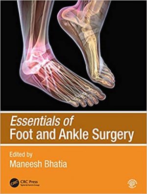 free-pdf-download-Essentials of Foot and Ankle Surgery