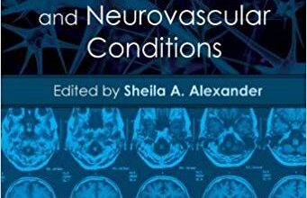 free-pdf-download-Evidence-Based Nursing Care for Stroke and Neurovascular Conditions