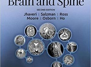 free-pdf-download-ExpertDDx: Brain and Spine 2nd Edition