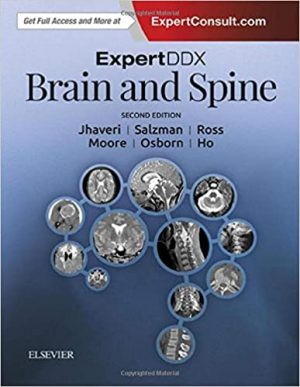 free-pdf-download-ExpertDDx: Brain and Spine 2nd Edition