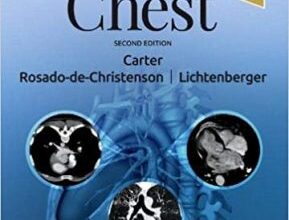 free-pdf-download-ExpertDDx: Chest 2nd Edition