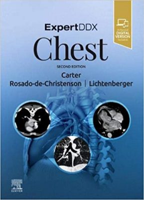 free-pdf-download-ExpertDDx: Chest 2nd Edition