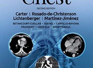 free-pdf-download-ExpertDDx: Chest 2nd Edition