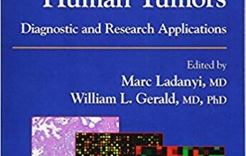 free-pdf-download-Expression Profiling of Human Tumors: Diagnostic and Research Applications