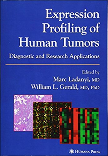 free-pdf-download-Expression Profiling of Human Tumors: Diagnostic and Research Applications