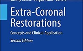 free-pdf-download-Extra-Coronal Restorations: Concepts and Clinical Application (BDJ Clinician’s Guides) 2nd ed. 2019 Edition