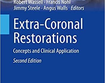 free-pdf-download-Extra-Coronal Restorations: Concepts and Clinical Application (BDJ Clinician’s Guides) 2nd ed. 2019 Edition