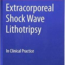 free-pdf-download-Extracorporeal Shock Wave Lithotripsy: In Clinical Practice