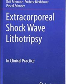 free-pdf-download-Extracorporeal Shock Wave Lithotripsy: In Clinical Practice