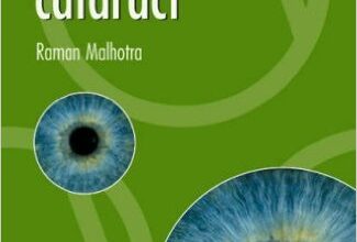 free-pdf-download-Eye Essentials: Cataract: Assessment