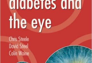 free-pdf-download-Eye Essentials: Diabetes and the Eye