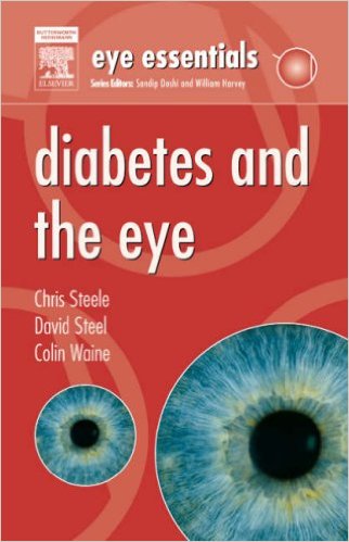 free-pdf-download-Eye Essentials: Diabetes and the Eye