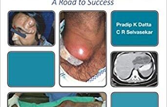 free-pdf-download-FRCS (General Surgery): A Road to Success