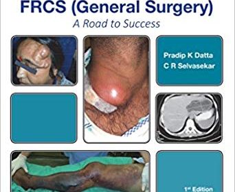 free-pdf-download-FRCS (General Surgery): A Road to Success