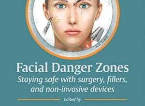 free-pdf-download-Facial Danger Zones: Staying safe with surgery