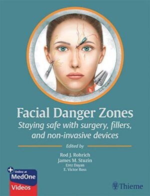 free-pdf-download-Facial Danger Zones: Staying safe with surgery