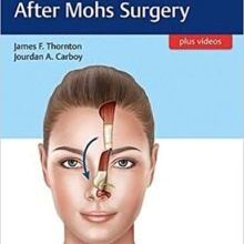 free-pdf-download-Facial Reconstruction After Mohs Surgery 1st Edition