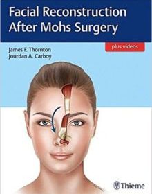 free-pdf-download-Facial Reconstruction After Mohs Surgery 1st Edition