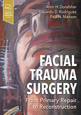 free-pdf-download-Facial Trauma Surgery: From Primary Repair to Reconstruction