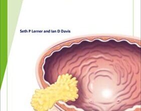 free-pdf-download-Fast Facts: Bladder Cancer