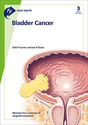 free-pdf-download-Fast Facts: Bladder Cancer