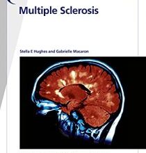 free-pdf-download-Fast Facts: Multiple Sclerosis: A new era of disease modification and treatment (May 2021 Release)