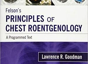 free-pdf-download-Felson’s Principles of Chest Roentgenology A Programmed 5th Edition