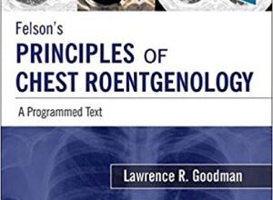 free-pdf-download-Felson’s Principles of Chest Roentgenology