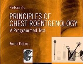 free-pdf-download-Felson’s Principles of Chest Roentgenology