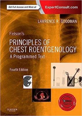 free-pdf-download-Felson’s Principles of Chest Roentgenology