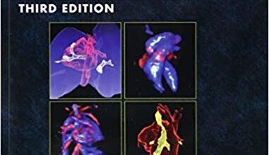 free-pdf-download-Fetal Cardiology: Embryology