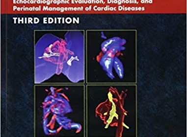 free-pdf-download-Fetal Cardiology: Embryology