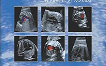 free-pdf-download-Fetal Cardiology Simplified: A Practical Manual 1st Edition