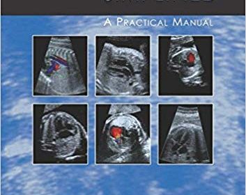 free-pdf-download-Fetal Cardiology Simplified: A Practical Manual 1st Edition