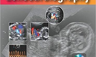 free-pdf-download-Fetal Echocardiography 1st Edition