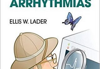 free-pdf-download-Field Guide to the Arrhythmias