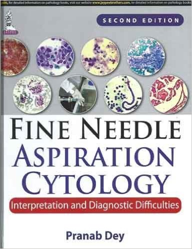 free-pdf-download-Fine Needle Aspiration Cytology Interpretation and Diagnostic Difficulties 2nd Edition