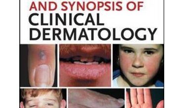 free-pdf-download-Fitzpatrick’s Color Atlas and Synopsis of Clinical Dermatology