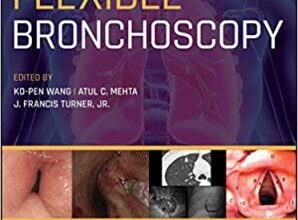 free-pdf-download-Flexible Bronchoscopy 4th Edition