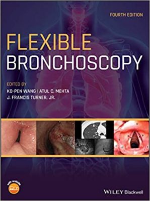 free-pdf-download-Flexible Bronchoscopy 4th Edition