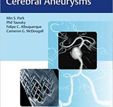 free-pdf-download-Flow Diversion of Cerebral Aneurysms 1st Edition