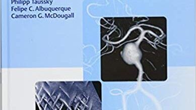 free-pdf-download-Flow Diversion of Cerebral Aneurysms 1st Edition