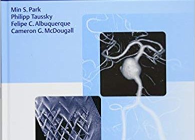 free-pdf-download-Flow Diversion of Cerebral Aneurysms 1st Edition