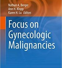 free-pdf-download-Focus on Gynecologic Malignancies (Energy Balance and Cancer) 1st ed. 2018 Edition