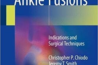 free-pdf-download-Foot and Ankle Fusions: Indications and Surgical Techniques 1st ed. 2018 Edition