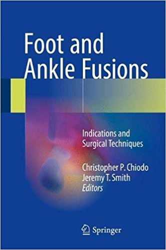 free-pdf-download-Foot and Ankle Fusions: Indications and Surgical Techniques 1st ed. 2018 Edition