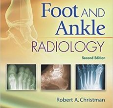 free-pdf-download-Foot and Ankle Radiology Second Edition