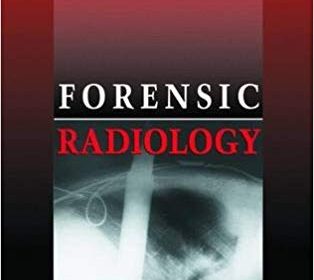 free-pdf-download-Forensic Radiology 1st Edition