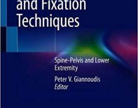 free-pdf-download-Fracture Reduction and Fixation Techniques: Spine-Pelvis and Lower Extremity