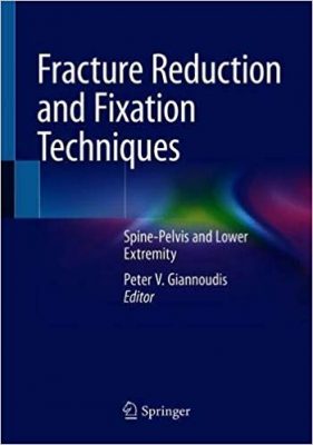 free-pdf-download-Fracture Reduction and Fixation Techniques: Spine-Pelvis and Lower Extremity